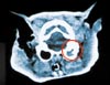 CT�f��