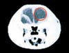 CT�f��