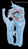 CT�f��